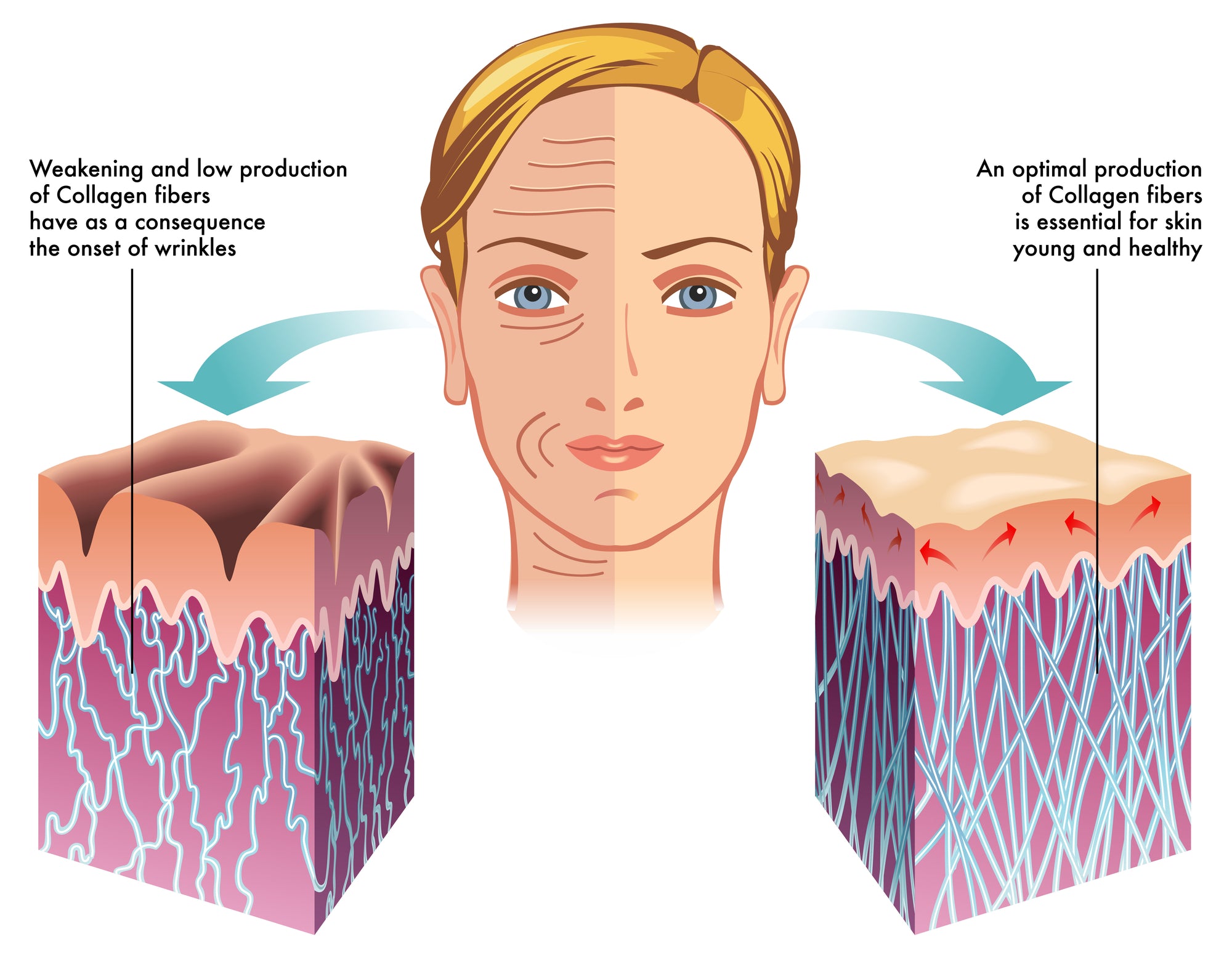 Collagen illustration | How face begins to sag